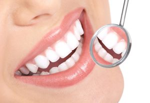 Healthy woman teeth and a dentist mouth mirror