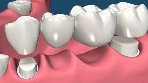 teeth, health, smile, dentist, dentalhealth,oralhealth